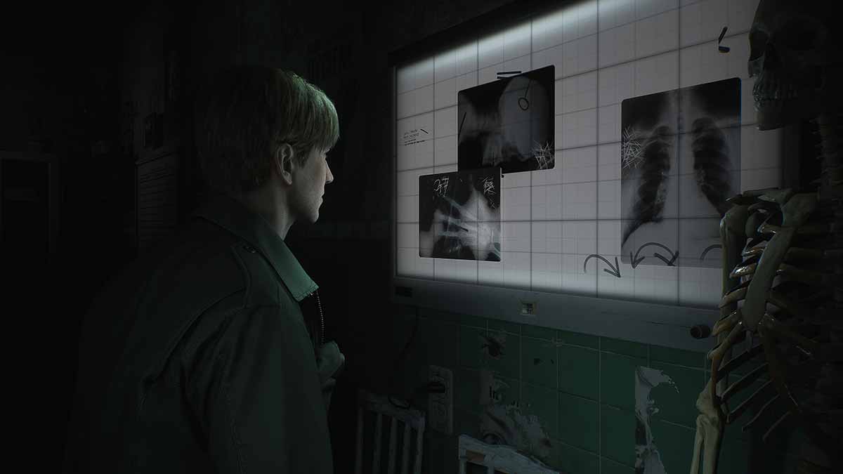 It looks like more Silent Hill Remakes are on the way